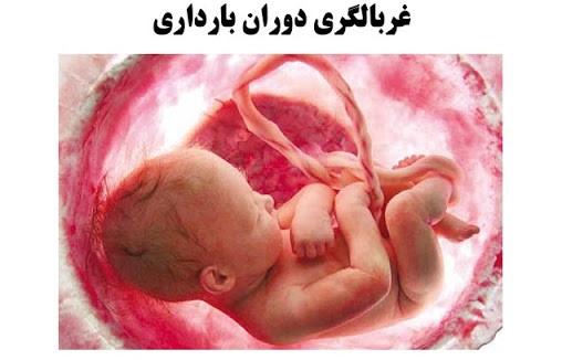 سیاستی که منجر به افزایش نوزاد سالم نمی شود سیاستی که منجر به افزایش نوزاد سالم نمی شود