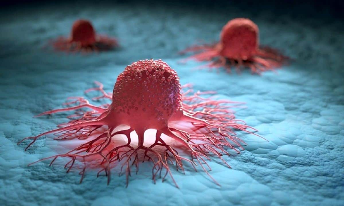 سرطان چیست و چگونه پدید می آید؟ / شایع ترین سرطان ها زنان و مردان را بشناسید!