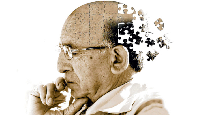 پیش‌بینی آغاز آلزایمر با کمک هوش مصنوعی