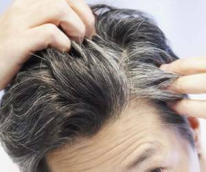 رفع سفیدی مو با درمان های طبیعی خانگی
