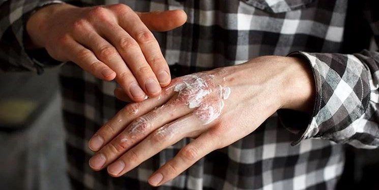 نسخه طب ایرانی برای پیشگیری و درمان خشکی پوست