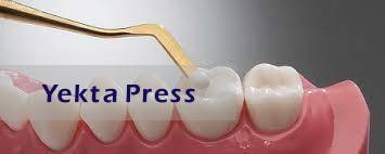 چه عواملی باعث لق شدن کامپوزیت دندان می شود؟