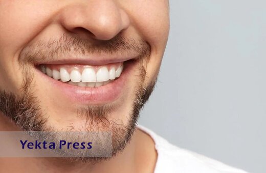با این سه روش دندان‌های سفیدتری داشته باشید