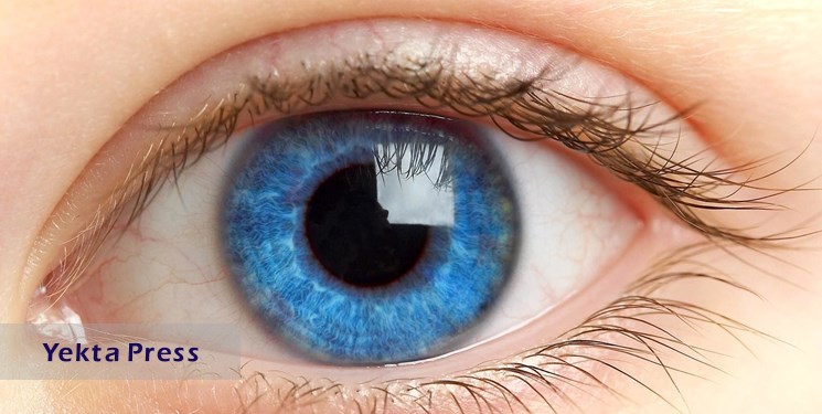 استفاده از «لنز زیبایی» در چشم چه خطری دارد؟