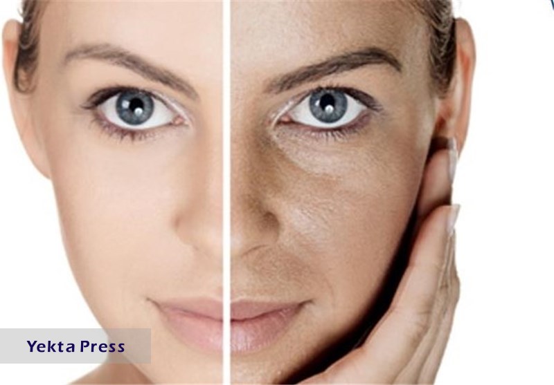 راهکارهای افزایش زیبایی پوست
