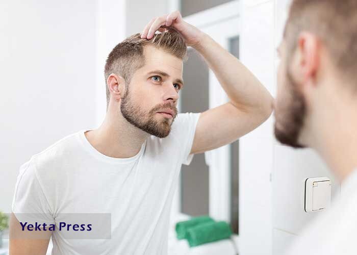 عوامل اصلی ریزش مو در مردان
