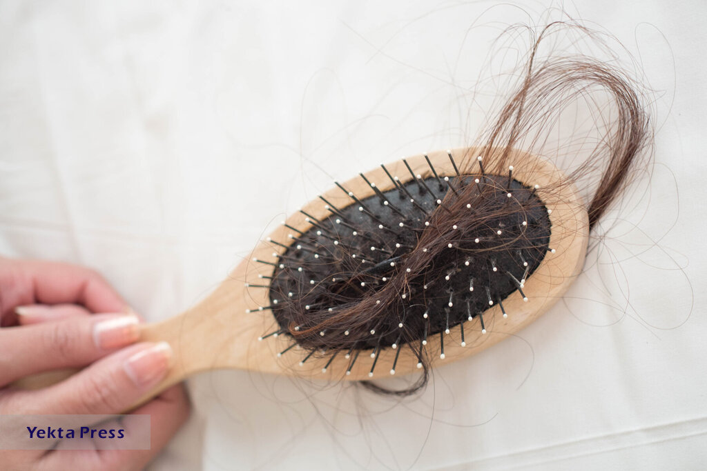 مهمترین علت ریزش مو را بشناسید