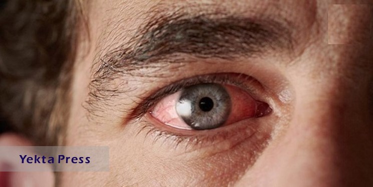 بیماری خاموش چشم را بشناسید