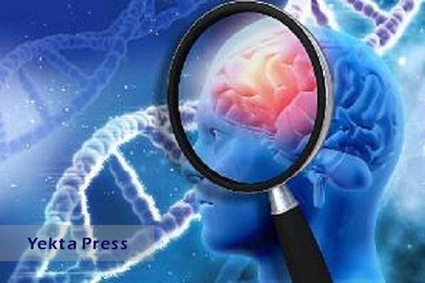 کشف علت جدید بیماری آلزایمر