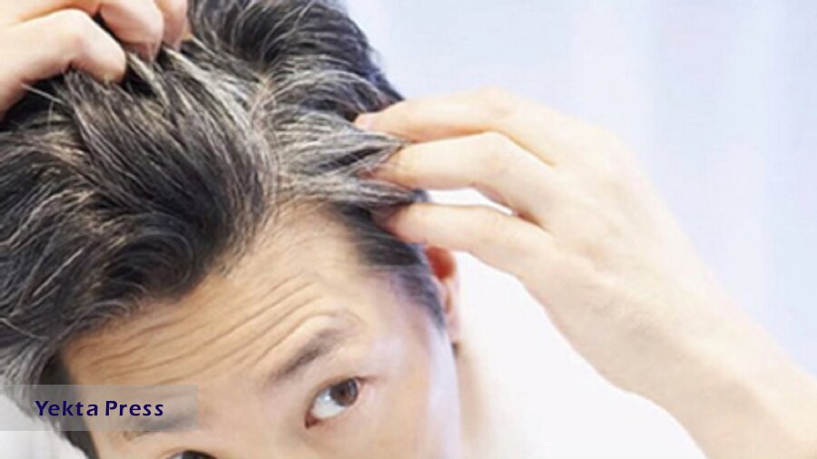عامل رایج سفید شدن مو