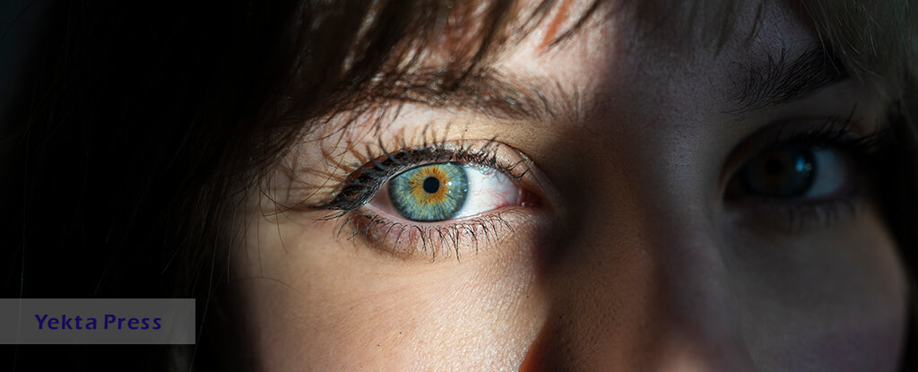 عمل ۲۵۰ میلیون تومانی برای تغییر رنگ چشم!