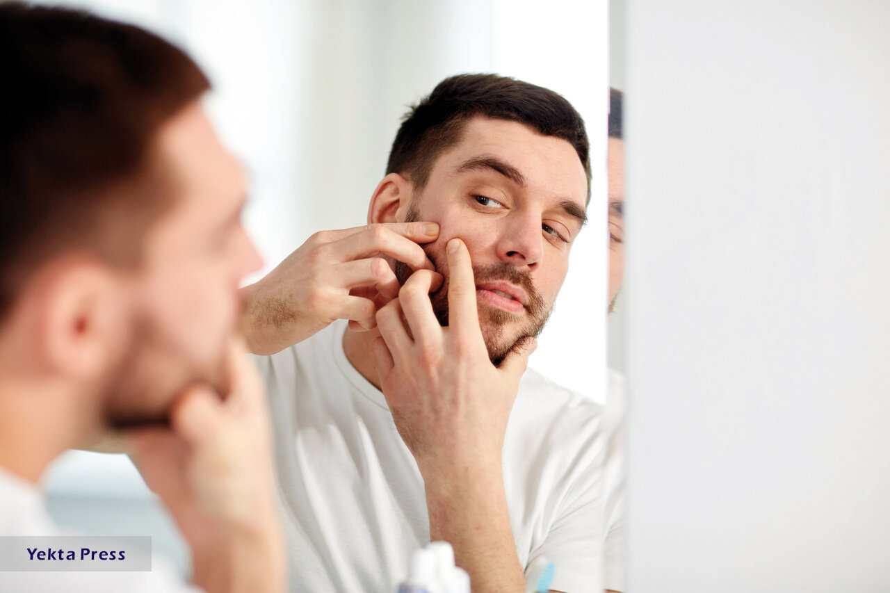 ۱۰ راهکار موثر برای از بین بردن جوش‌های صورت