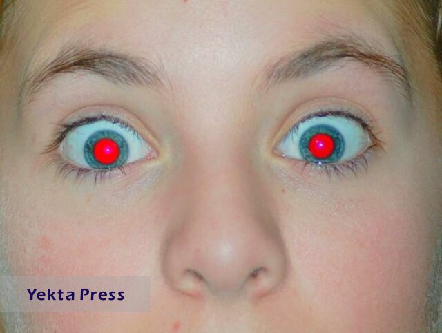قرمز شدن مردمک چشم در عکس‌ها نشانه بیماری است؟