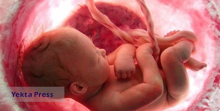 اهمیت انجام تست‌های غربالگری جنین برای تمامی مادران باردار