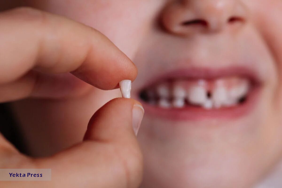اهمیت دندان شیری و تاثیر آنها روی دندان‌های دائمی
