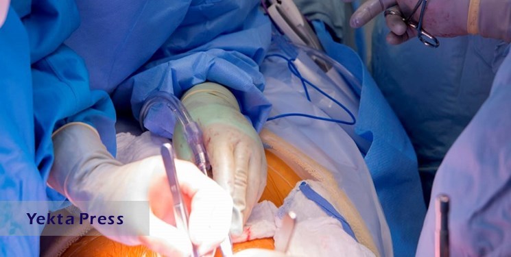 انجام عمل جراحی پیوند کبد توسط متخصصان ایرانی