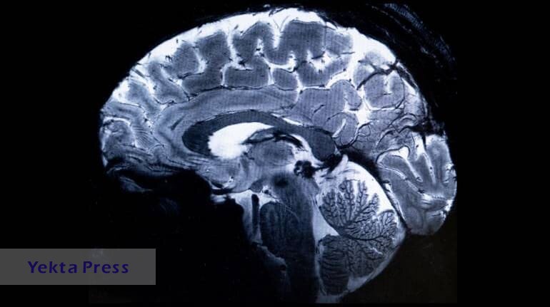 ثبت واضح‌ترین تصویر مغز با فناوری جدید